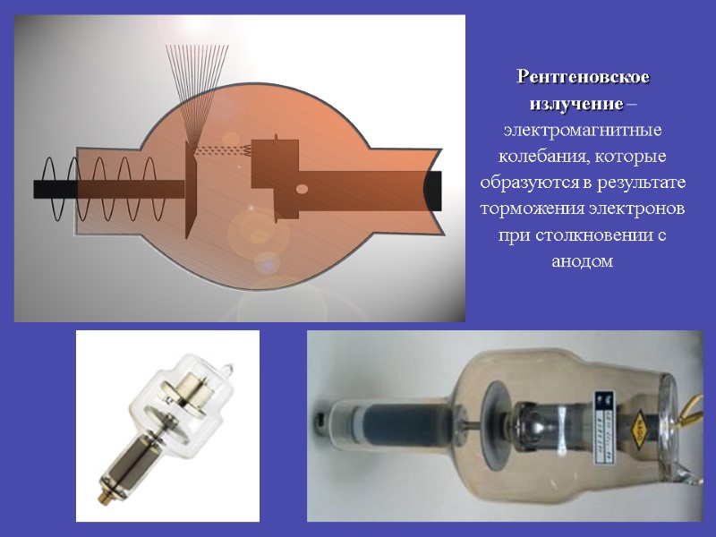 Рентгеновское излучение – электромагнитные колебания, которые образуются в результате торможения электронов при столкновении с